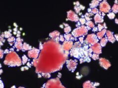 Microplastics block blood flow in the brain, mice study reveals